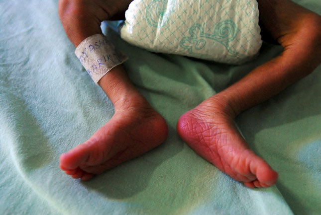 Infant Survival Unit in Indian Hospital