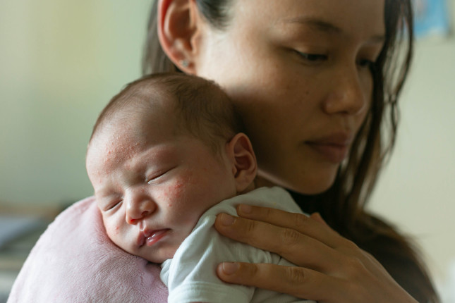 A,Depressed,Mother,Holding,Her,Baby,With,Skin,Problems.